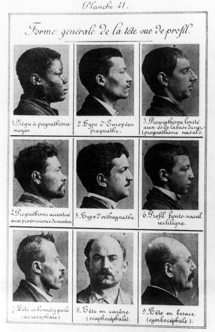 BERTILLON